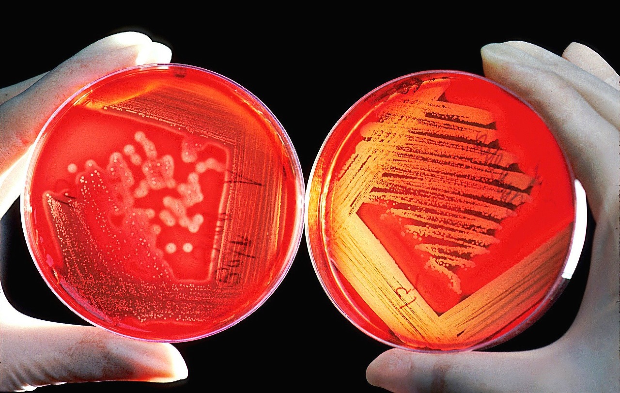 Zwei Nährböden mit Mikroorganismen im Gegenlicht. Foto WikiImages (Pixabay 2020)